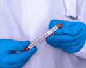 Does Cialis affect Testosterone levels?
